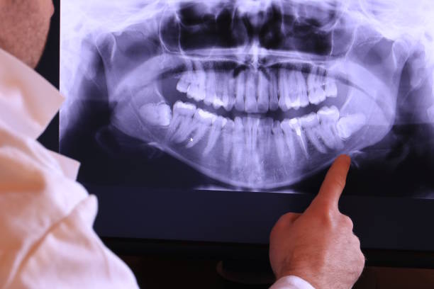 Best Emergency Gum Treatment in Garfield Heights, OH